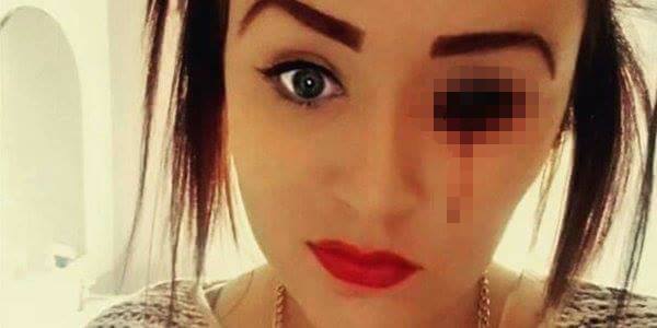 C&ocirc; g&aacute;i người Anh mắc căn bệnh qu&aacute;i lạ. Ảnh: Cosmopolitan