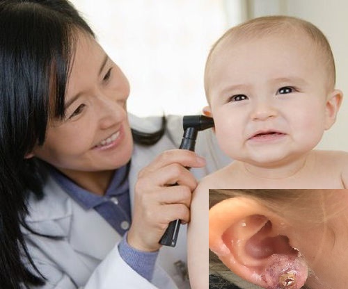  Bấm lỗ tai cho trẻ ngay từ khi c&ograve;n nhỏ tiềm ẩn nhiều nguy cơ