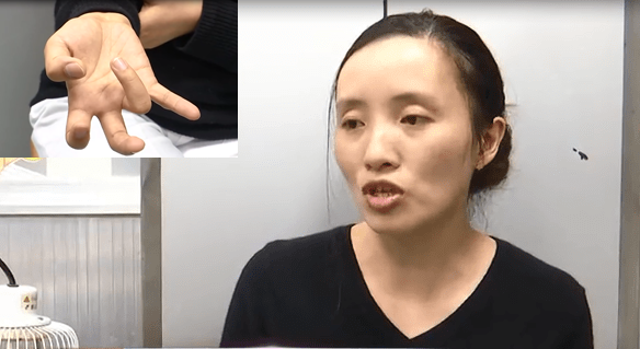  Người phụ nữ bị liệt tay v&igrave; chơi game li&ecirc;n tục trong suốt một tuần