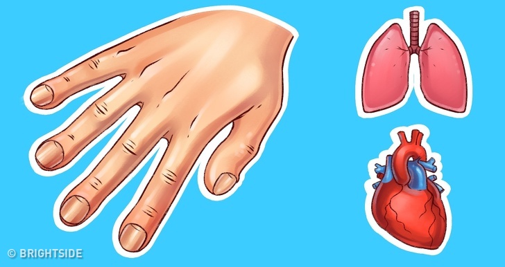  Ng&oacute;n tay khẳng khiu, đốt ng&oacute;n tay ph&aacute;t triển kh&ocirc;ng đều th&igrave; c&oacute; thể l&agrave; do thiếu oxy hoặc mắc bệnh nguy hiểm