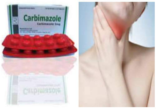 Thuốc carbimazole điều trị tuyến gi&aacute;p c&oacute; thể g&acirc;y dị tật bẩm sinh ở thai nhi nếu sử dụng ở 3 th&aacute;ng đầu thai kỳ