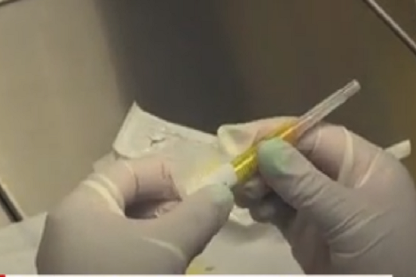 Đ&atilde; loại bỏ HIV khỏi DNA của những con chuột bị nhiễm bệnh