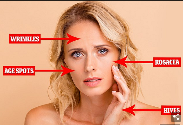Kh&oacute;i bụi khiến da h&igrave;nh th&agrave;nh đồi mồi v&agrave; l&atilde;o h&oacute;a nhanh kh&ocirc;ng ngờ