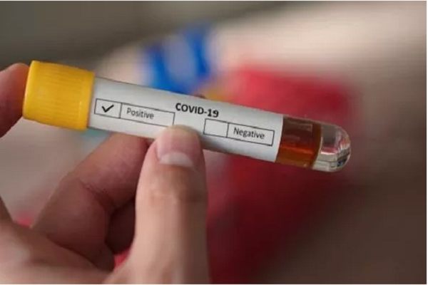 Cơ quan gi&aacute;m s&aacute;t y tế cảnh b&aacute;o về việc b&aacute;n tr&aacute;i ph&eacute;p bộ dụng cụ thử nghiệm Covid-19