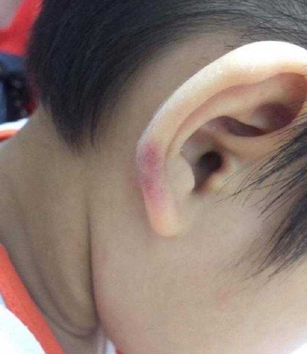 C&ocirc; gi&aacute;o mầm non đ&aacute;nh con ri&ecirc;ng của chồng: Người trong cuộc l&ecirc;n tiếng