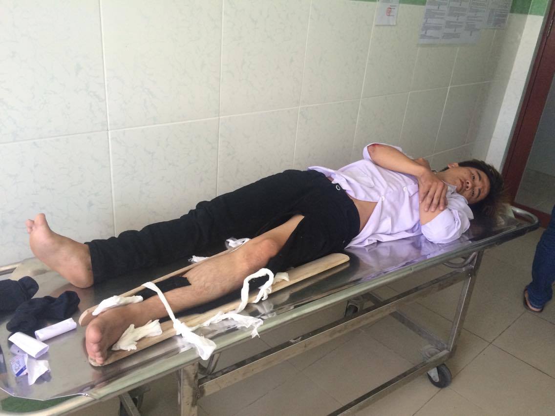 Ẩn - thanh ni&ecirc;n điều khiển xe gắn m&aacute;y g&acirc;y tai nạn giao th&ocirc;ng hiện đang cấp cứu ở bệnh viện