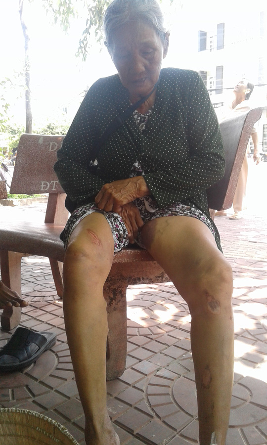 B&agrave; cụ bị đa chấn thương