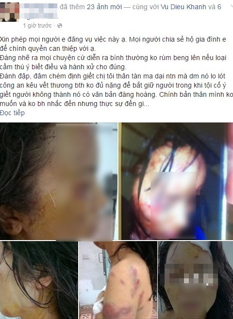 rên mạng xã hội nickname H.N đã đăng tải những hình ảnh của một người phụ nữ được cho là bị chồng cũ đánh đập rên mạng xã hội nickname H.N đã đăng tải những hình ảnh của một người phụ nữ được cho là bị chồng cũ đánh đập