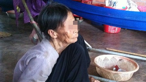 Cụ Nguyện đ&atilde; 85 tuổi c&ograve;n bị con g&aacute;i đ&aacute;nh đập chỉ v&igrave; muốn chiếm đoạt mảnh đất