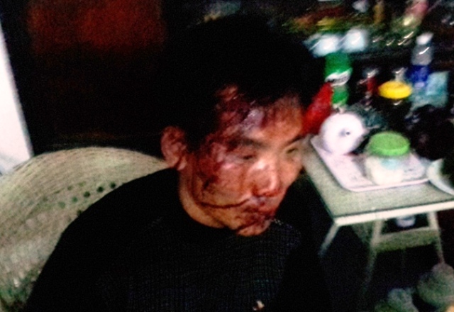  anh Ninh Văn Ho&agrave;n