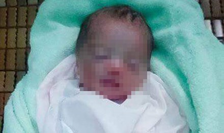 Trước đ&oacute; v&agrave;i ng&agrave;y, người d&acirc;n Huế cũng ph&aacute;t hiện một em b&eacute; bị bỏ rơi ở bụi chuối.