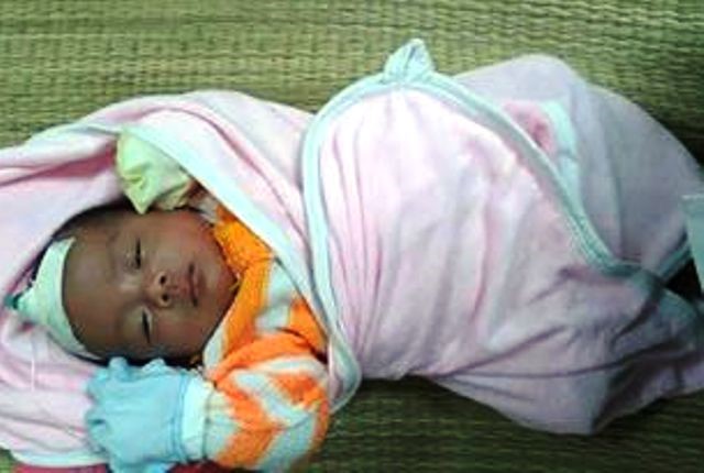 B&eacute; g&aacute;i bị ngộ độc kh&iacute; CO nay đ&atilde; b&igrave;nh phục
