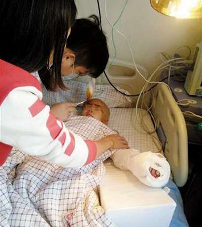 C&aacute;c b&aacute;c sĩ cho biết, c&aacute;c bộ phận bị đứt l&igrave;a của nạn nh&acirc;n được gắn lại l&agrave; kh&ocirc;ng cao 