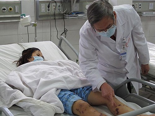 L&agrave; căn bệnh nguy hiểm nhưng n&atilde;o m&ocirc; cầu lại c&oacute; thể ph&ograve;ng ngừa hiệu quả bằng vắc xin