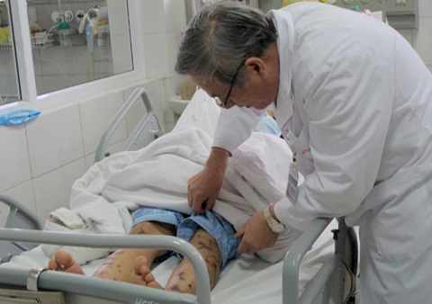 Bệnh n&atilde;o m&ocirc; cầu cướp t&iacute;nh mạng trong v&ograve;ng 24h xuất hiện tại H&agrave; Nội