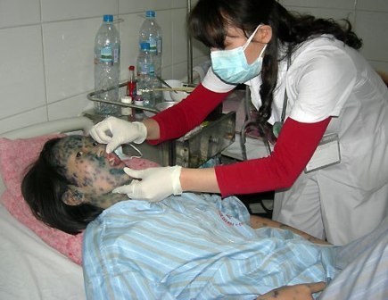 Bệnh thủy đậu rất dễ l&acirc;y lan th&agrave;nh dịch v&igrave; vậy cần c&oacute; biện ph&aacute;p ph&ograve;ng ngừa kịp thời