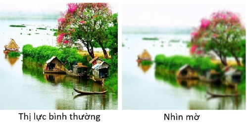 H&atilde;y cảnh gi&aacute;c trước những dấu hiệu bất thường của mắt