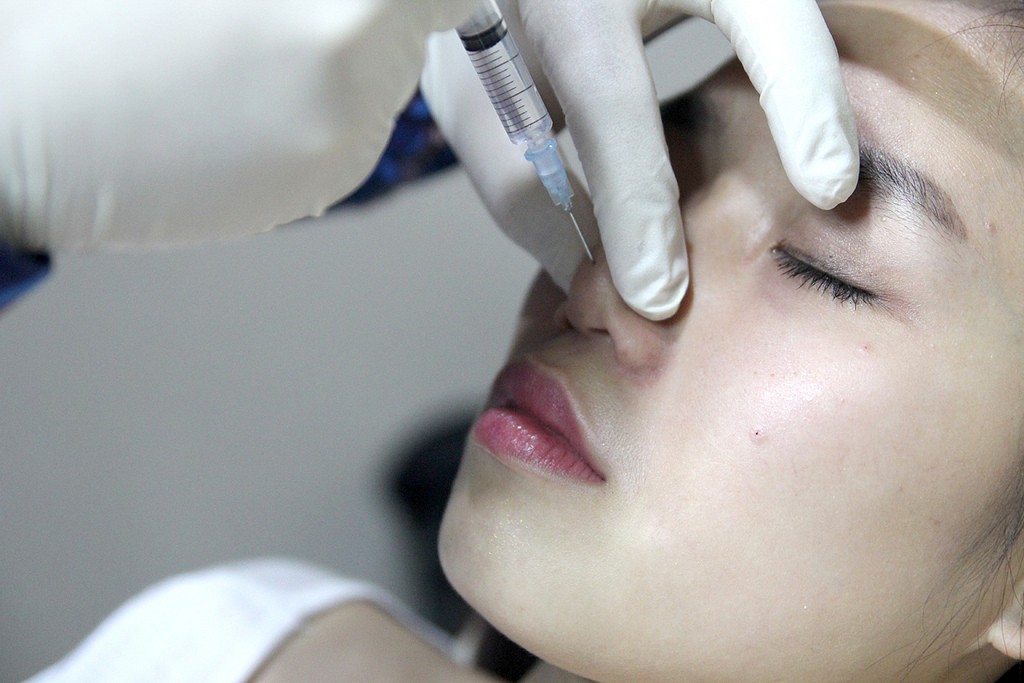 T&aacute;c hại từ liệu ph&aacute;p ti&ecirc;m botox chống nhăn da