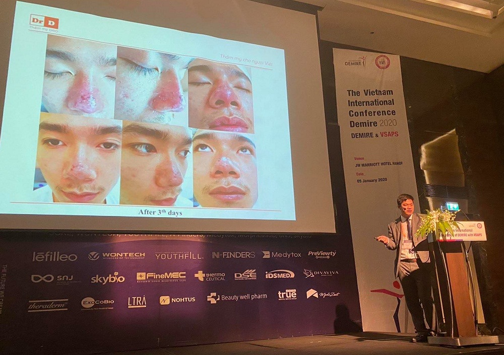 B&aacute;c sĩ L&ecirc; Hữu Điền chia sẻ c&aacute;c tai biến do thực hiện kh&ocirc;ng đ&uacute;ng quy tr&igrave;nh th&acirc;̉m mỹ
