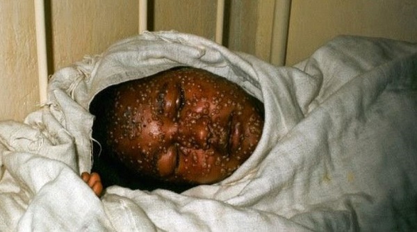 c&aacute;ch ph&ograve;ng tr&aacute;nh đại dịch ebola 4
