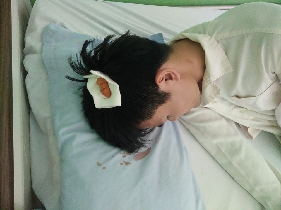 C&aacute;n bộ địa ch&iacute;nh x&atilde; T&acirc;n Trường L&ecirc; Minh Ph&uacute; bị đ&aacute;nh vỡ đầu