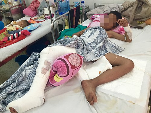 Trường hợp của b&eacute; Trần l&agrave; ca khỉ căn người nghi&ecirc;m trọng nhất m&agrave; bệnh viện Nhi Đồng 2 từng tiếp nhận