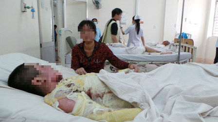 Hiện cả 2 cha con trong vụ cha tưới xăng đốt con gái đang phải điều trị vì bỏng nặng Hiện cả 2 cha con trong vụ cha tưới xăng đốt con gái đang phải điều trị vì bỏng nặng
