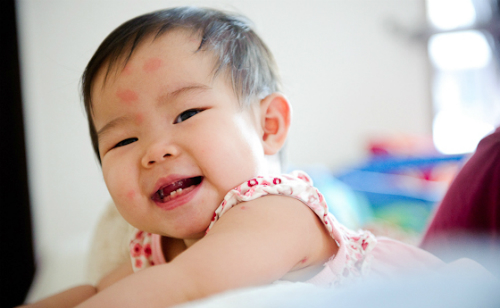 Chọn kem chống muỗi ph&ograve;ng sốt xuất huyết cho b&eacute;