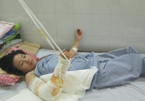 Chồng cắt g&acirc;n ch&acirc;n, tay vợ