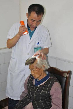 Trường hợp của &lsquo;b&agrave; cụ kỳ l&acirc;n&rsquo; l&agrave; một trong những c&acirc;u chuyện lạ c&oacute; thật về người mọc sừng tr&ecirc;n thế giới