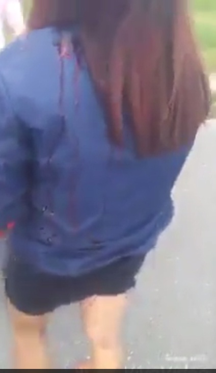 Video nữ sinh bị đ&aacute;nh hội đồng cho thấy nạn nh&acirc;n chảy rất nhiều m&aacute;u sau khi bị gậy sắt quật v&agrave;o đầuVideo nữ sinh bị đ&aacute;nh hội đồng cho thấy nạn nh&acirc;n chảy rất nhiều m&aacute;u sau khi bị gậy sắt quật v&agrave;o đầu