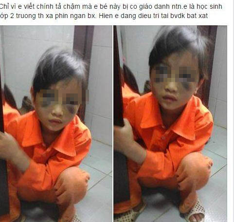 Chỉ v&igrave; viết b&agrave;i chậm m&agrave; nữ sinh tiểu học n&agrave;y bị c&ocirc; gi&aacute;o đ&aacute;nh cho t&iacute;m mặt