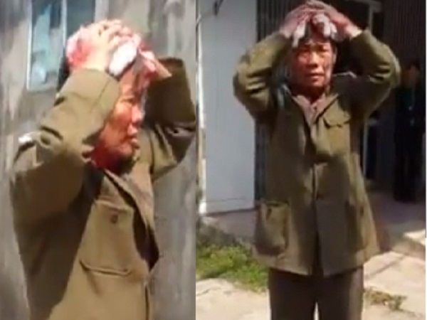 &Ocirc;ng bố chồng bị chảy rất nhiều m&aacute;u 