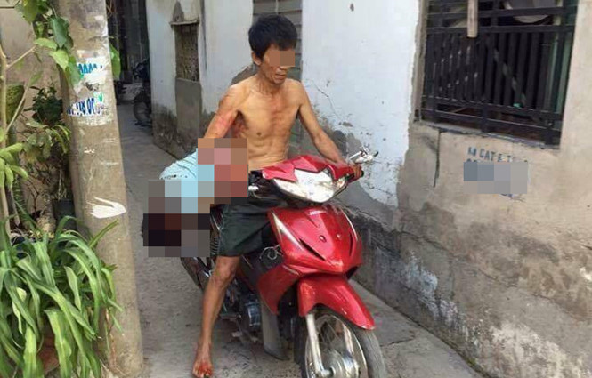 H&igrave;nh ảnh g&acirc;y chấn động những ng&agrave;y qua