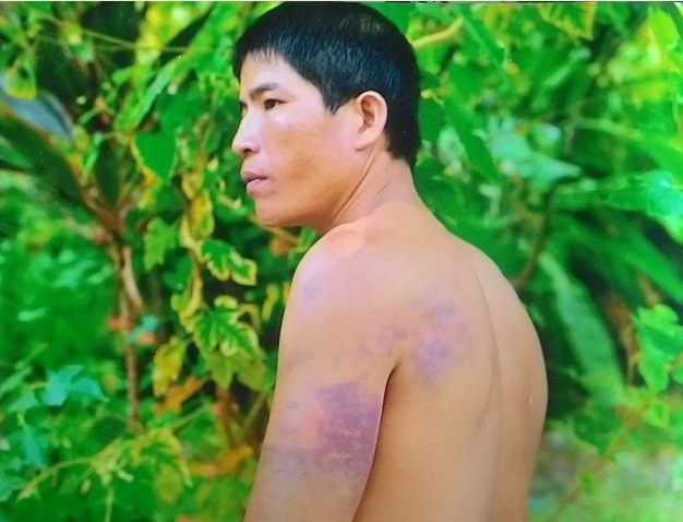 Đ&atilde; từng c&oacute; kh&ocirc;ng &iacute;t vụ việc tố c&ocirc;ng an đ&aacute;nh d&acirc;n g&acirc;y bức x&uacute;c trong dư luận thời gian qua