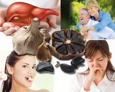 Tỏi đen c&oacute; gi&aacute; đắt đỏ v&agrave; đa dạng c&ocirc;ng nghệ chế biến