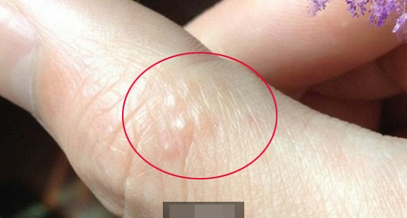 Những dấu hiệu cơ thể ai cũng từng gặp nhưng lại kh&ocirc;ng biết nguy&ecirc;n do