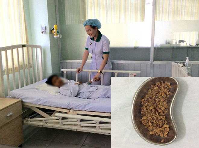  H&igrave;nh ảnh cậu b&eacute; phải nằm viện v&igrave; ăn 700gram hạt quả sơ ri. Ảnh: Zing News