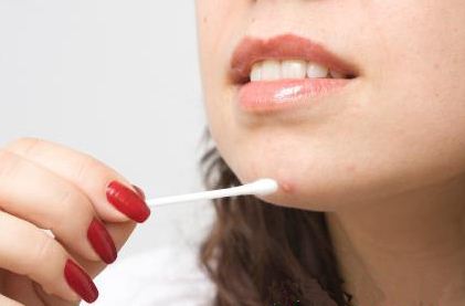 Vị tr&iacute; mụn mọc tr&ecirc;n mặt n&oacute;i g&igrave; về t&igrave;nh trạng 13Win19 ưu đãi hấp dẫn