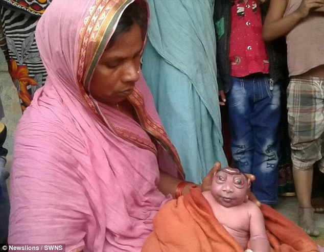 B&eacute; sơ sinh Ấn Độ giống người ngo&agrave;i h&agrave;nh tinh. Ảnh: Daily Mail