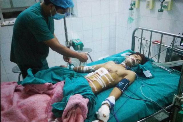 Bệnh nh&acirc;n Tiến đang điều trị tại khoa Phẫu thuật - G&acirc;y m&ecirc; hồi sức (BV Tuy&ecirc;n Quang) sau vụ nổ đ&egrave;n pin Trung Quốc