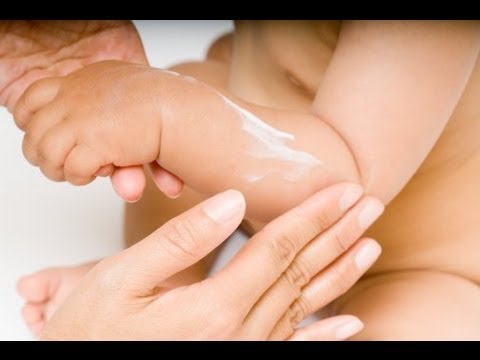 Kem vi&ecirc;m da trẻ em chứa c&aacute;c th&agrave;nh phần dễ g&acirc;y dị ứng cho trẻ