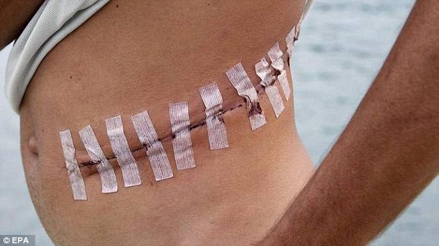 H&igrave;nh ảnh một nạn nh&acirc;n bị khủng bố IS lấy nội tạng 