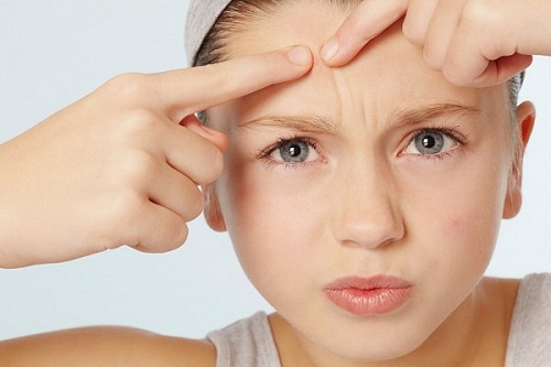 Mụn trứng cá là nguyên nhân khiến chị em thiếu tự tin