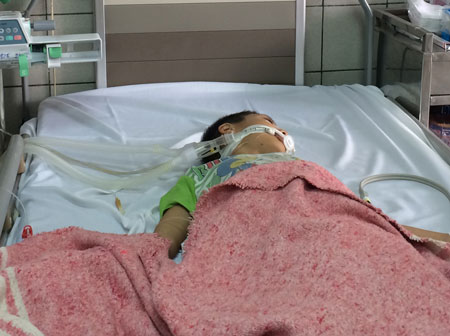 B&eacute; Nguyễn Trọng Lực đ&atilde; bị ngộ độc do ăn sắn nướng