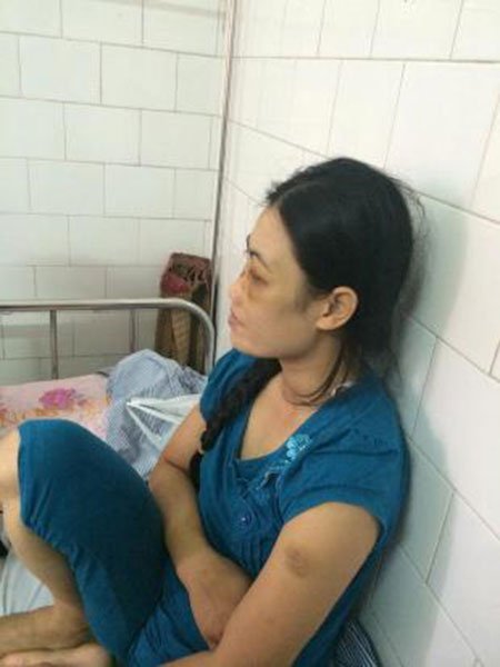 người vợ bị chồng bắt ăn ph&acirc;n lợn