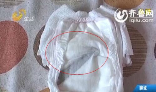 Vị tr&iacute; lưỡi dao cực kỳ kh&oacute; ph&aacute;t hiện v&igrave; nằm ở sườn trong t&atilde; l&oacute;t