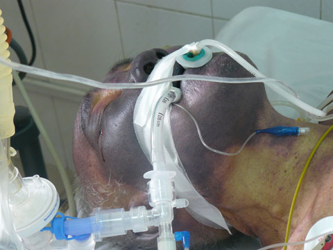 Tiết canh chứa chất g&acirc;y độc hại v&agrave; bản th&acirc;n n&oacute; mang nguy cơ g&acirc;y ung thư, vi&ecirc;m m&agrave;ng n&atilde;o thậm ch&iacute; tử vong cho thực kh&aacute;ch
