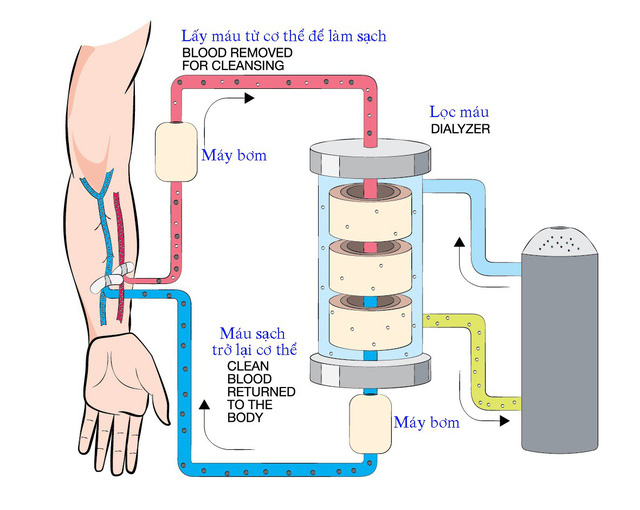 Hạn chế ăn những thứ n&agrave;y nếu kh&ocirc;ng muốn phải chạy thận cả đời