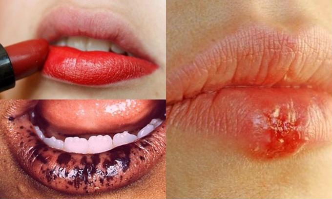 Nếu ĐẸP m&agrave; ĐỘC th&igrave; ĐỪNG